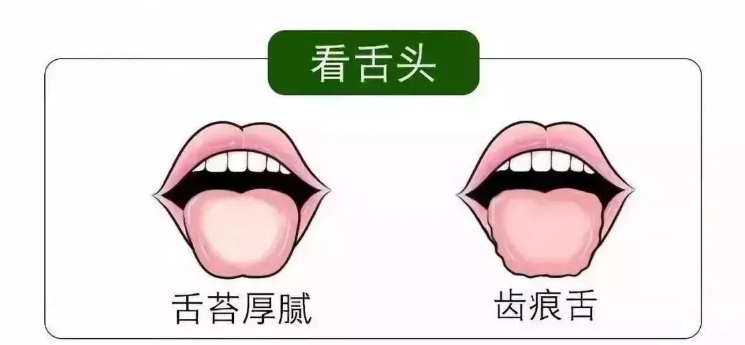 清明時節雨紛紛 疏通經絡馬上給身體加分！